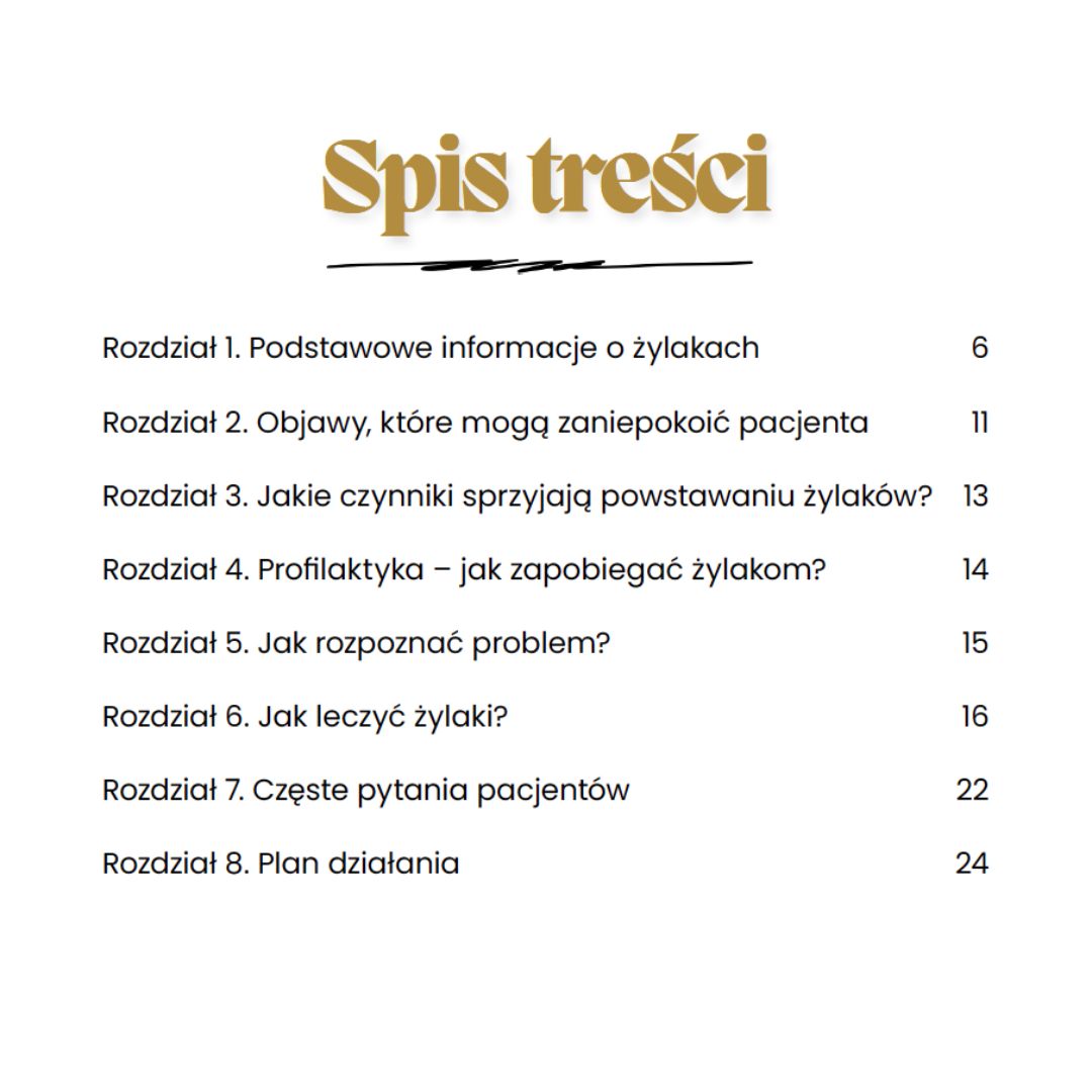 żylaki leczenie