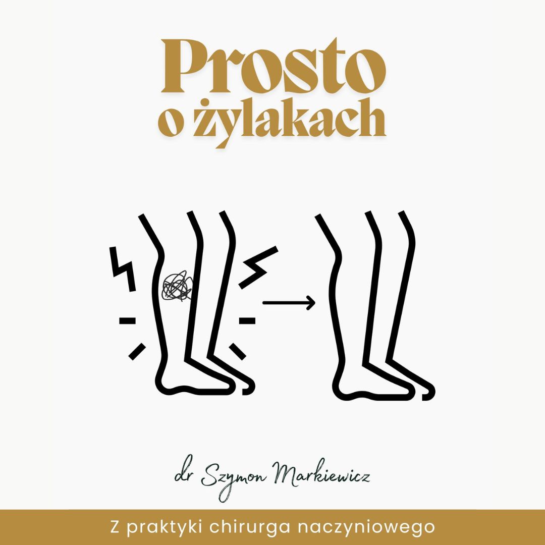 żylaki leczenie